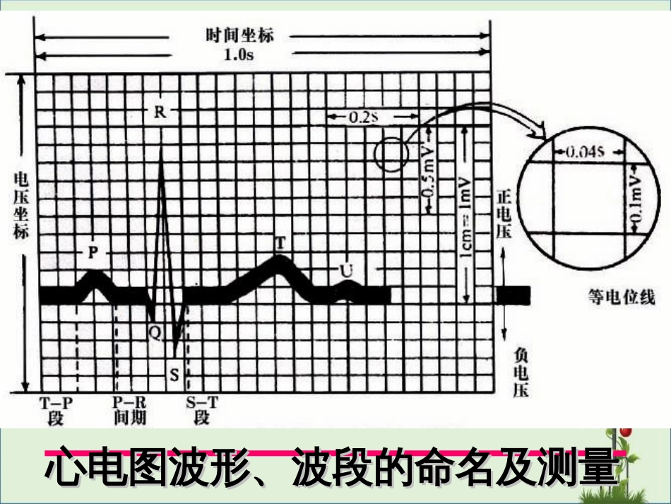 -异常心电图图谱汇总_第3页