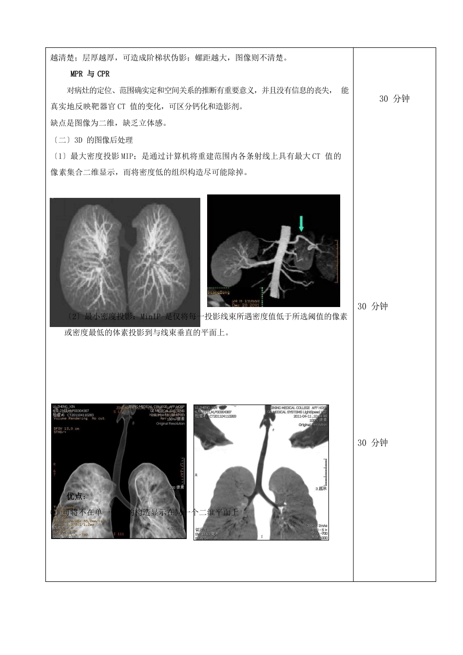 1CT图像后处理技术_第3页