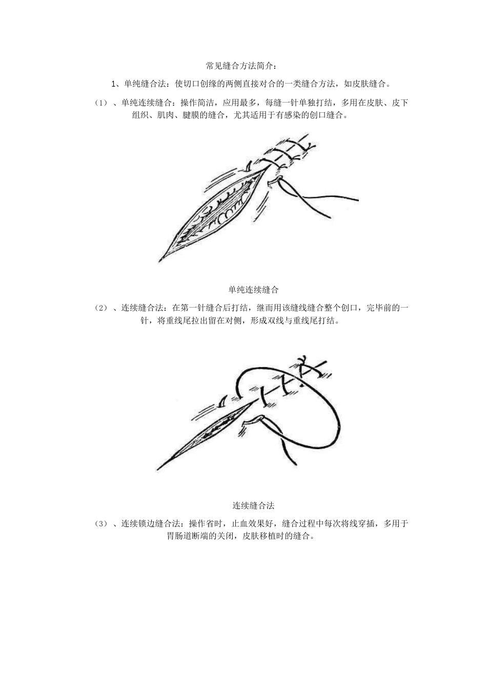 常见缝合方法简介_第1页