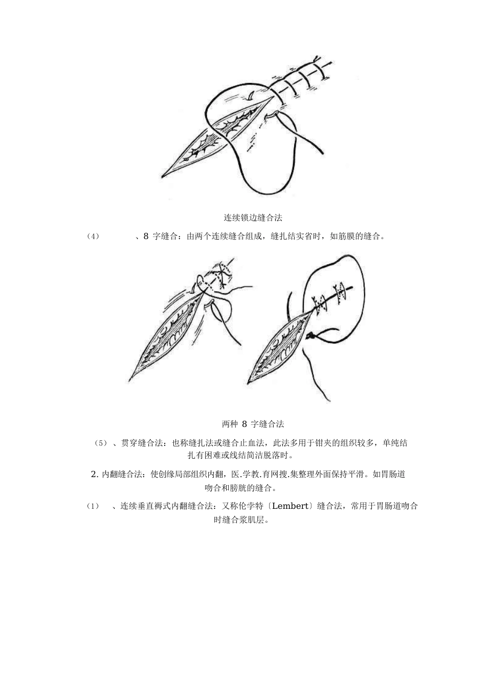 常见缝合方法简介_第2页