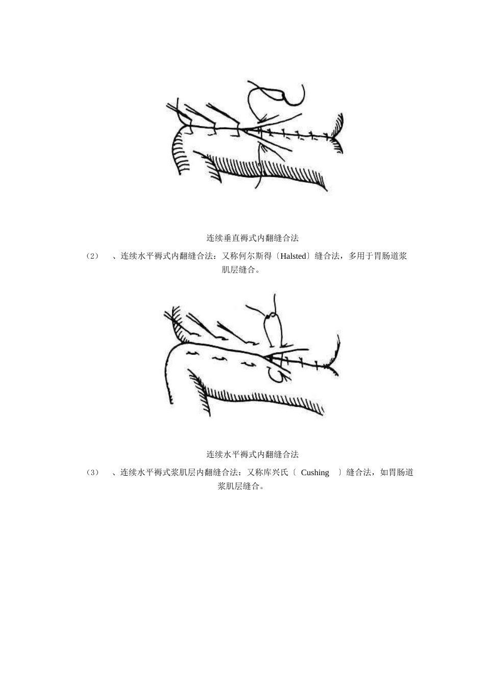 常见缝合方法简介_第3页