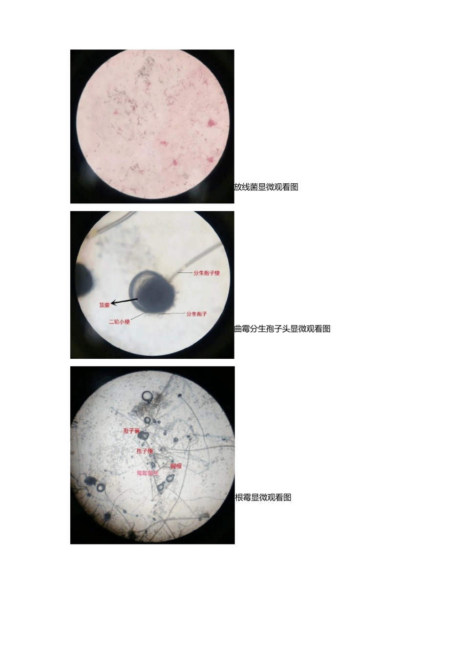 放线菌和霉菌的形态观察_第3页