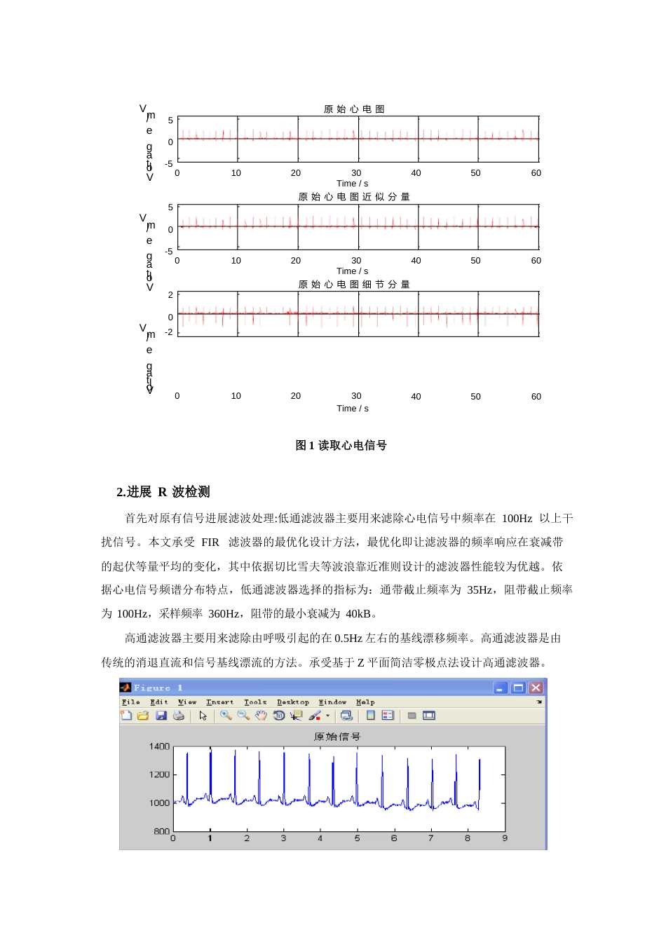 心电信号R波检测分析与处理_第3页