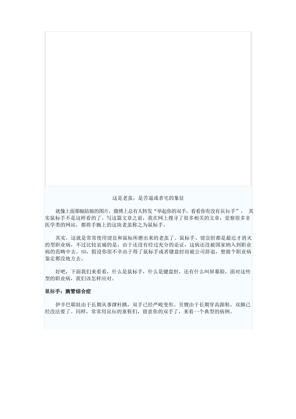鼠标手和键盘肘_第2页