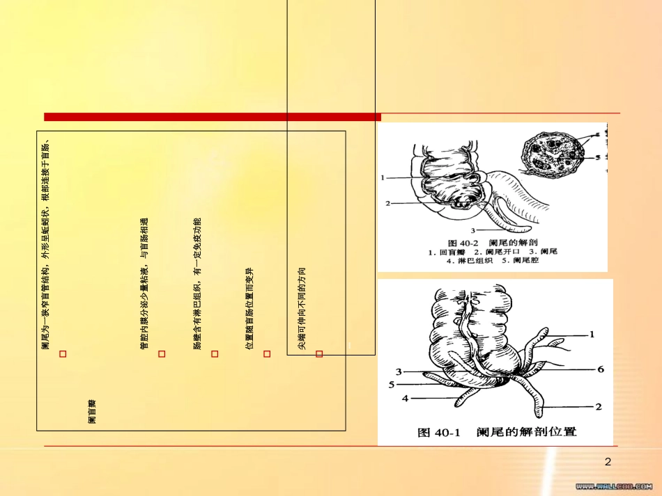 阑尾护理查房[共42页]_第2页