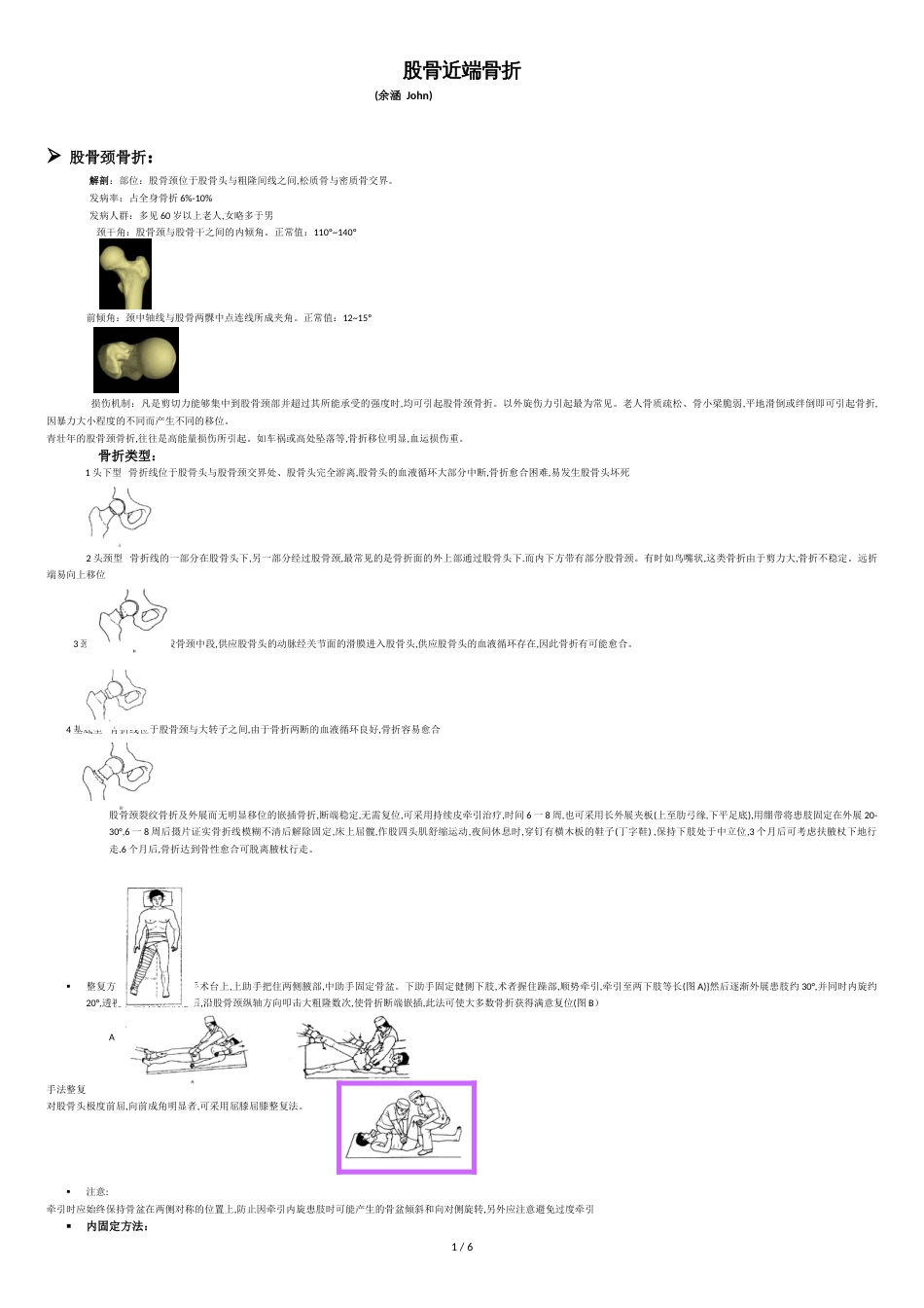 髋关节股骨骨折及后期康复[共7页]_第1页