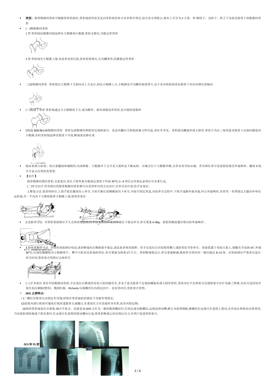 髋关节股骨骨折及后期康复[共7页]_第3页