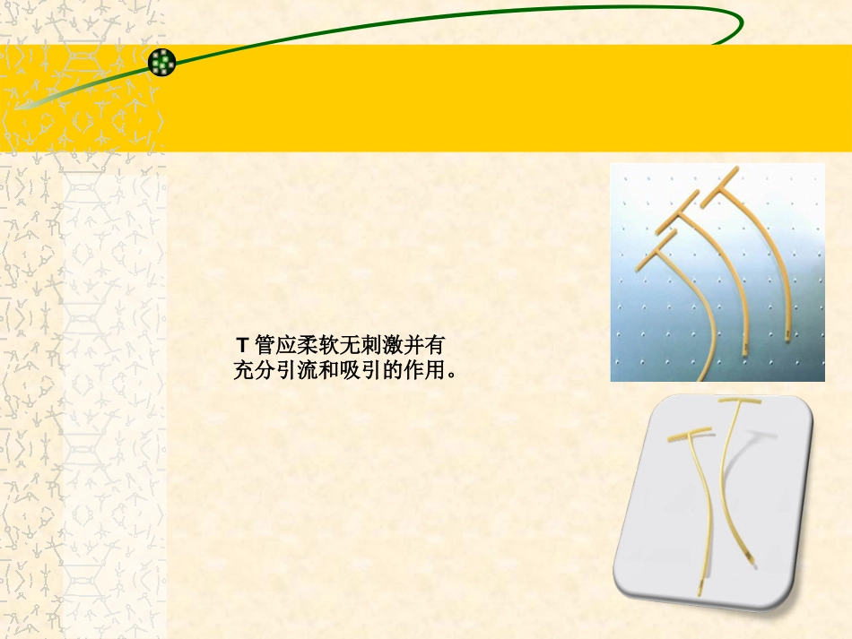 T管护理ppt_第3页