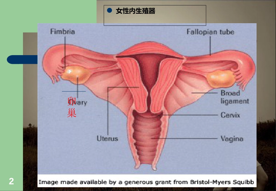 2019年Ovarian-carcinom-卵巢肿瘤.ppt[共48页]_第2页