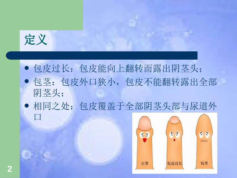 包皮环切术ppt课件[共34页]_第2页