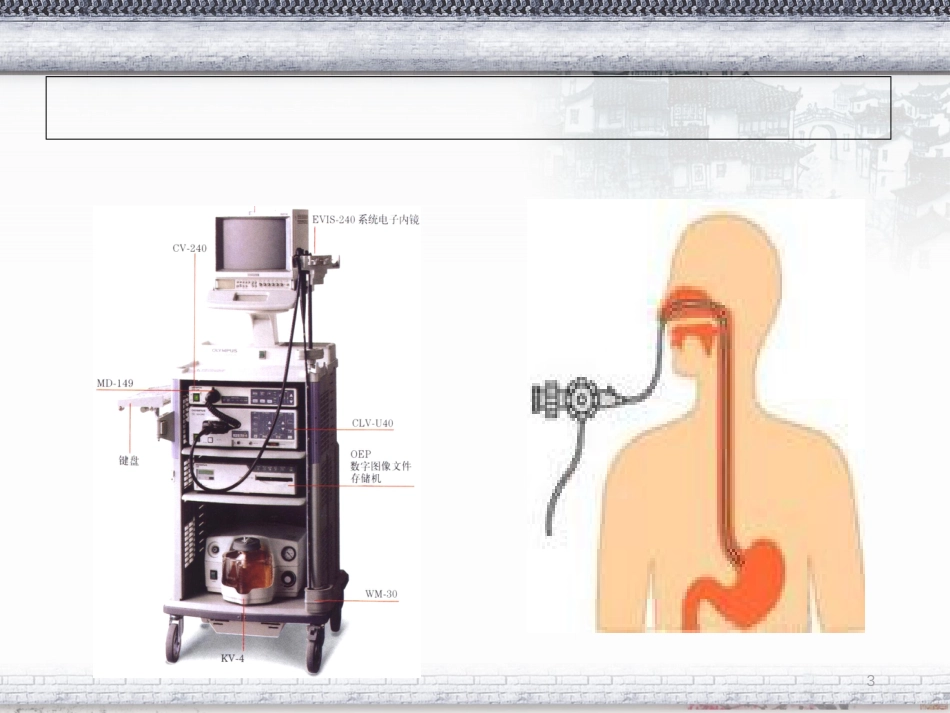 常见消化内镜的诊治[共50页]_第3页