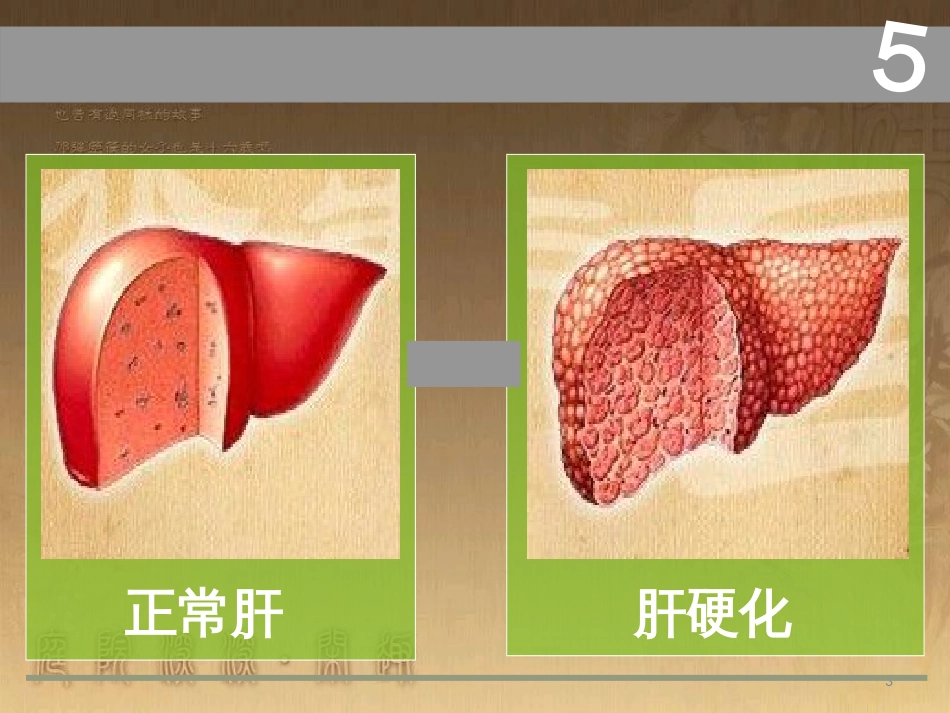 肝硬化ppt[共68页]_第3页