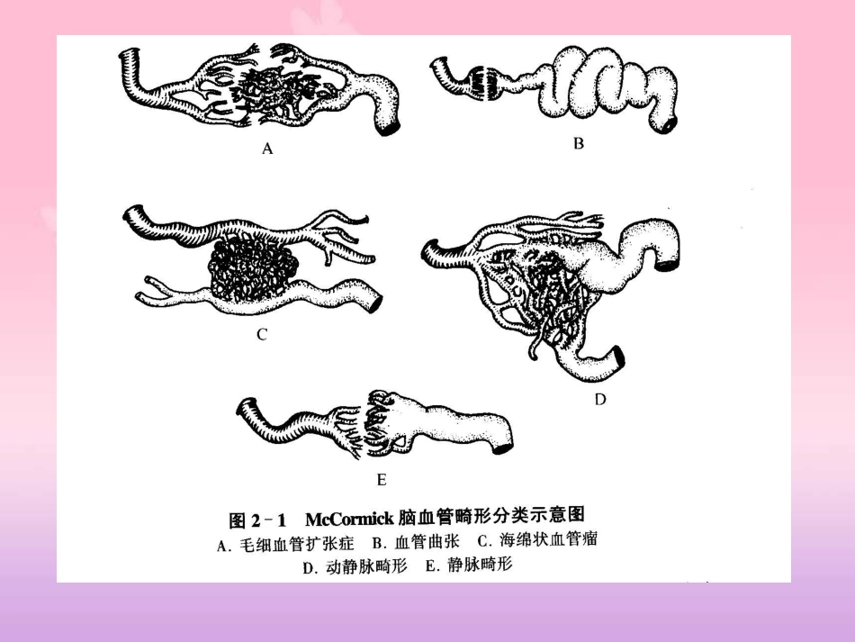 大脑动静脉畸形影像表现[共55页]_第3页