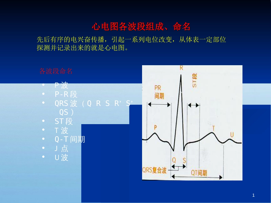 各种心电图表现[共53页]_第1页