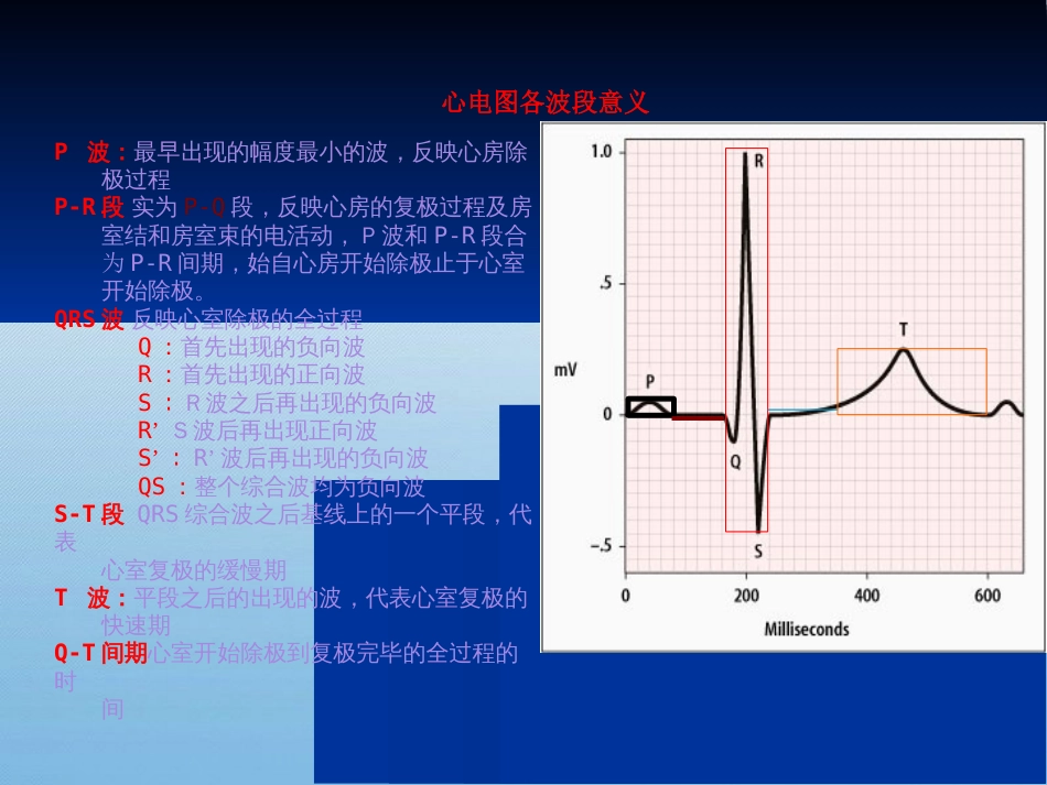 各种心电图表现[共53页]_第2页