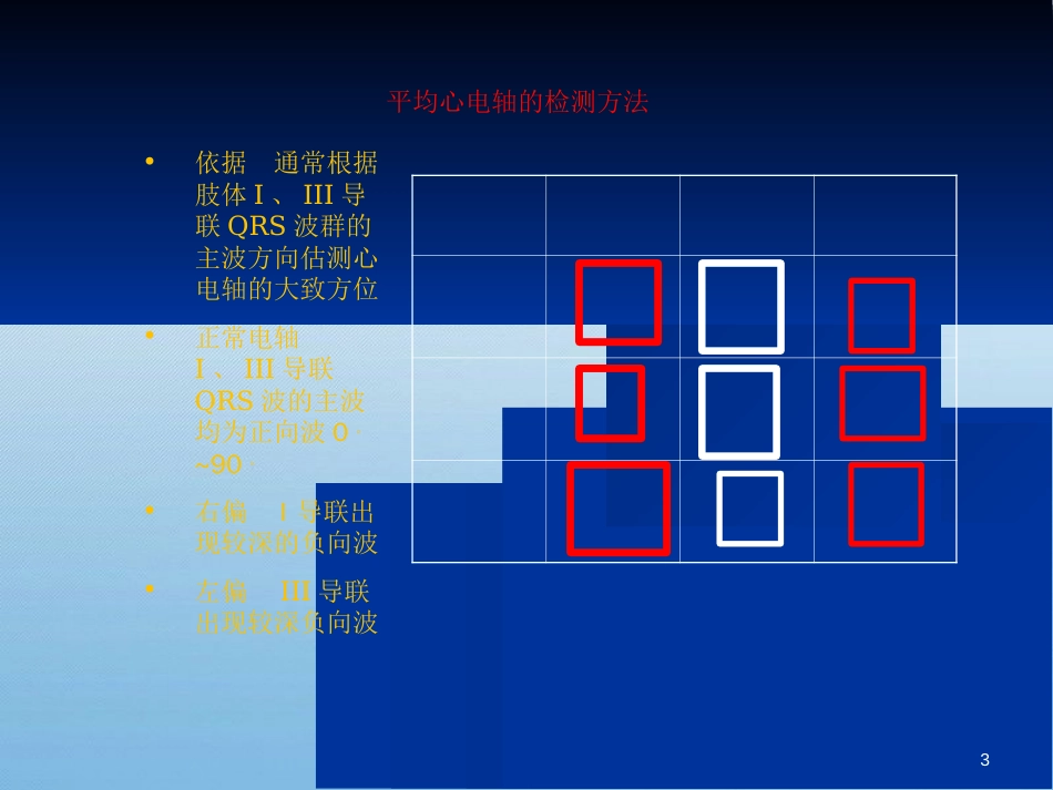 各种心电图表现[共53页]_第3页