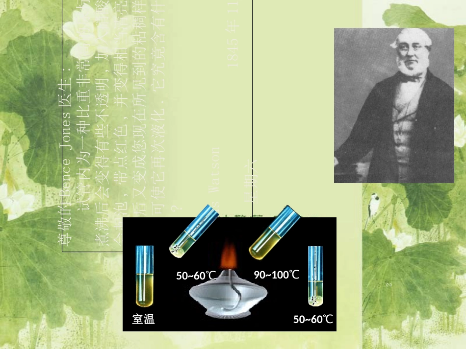 多发性骨髓瘤的影像学表现[共60页]_第2页