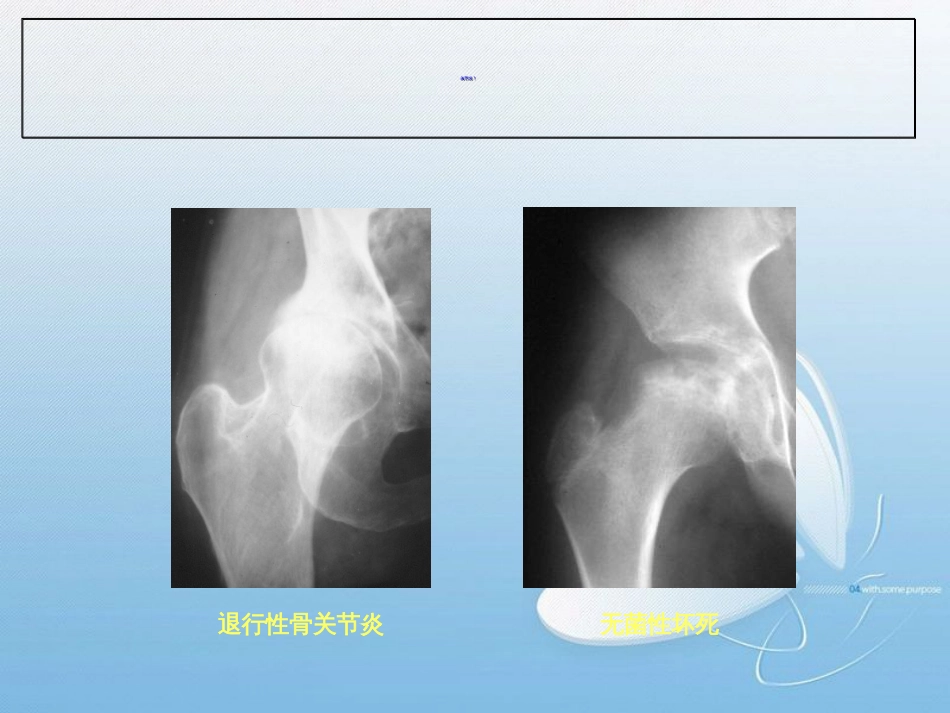 关节炎的影像学表现[共126页]_第3页