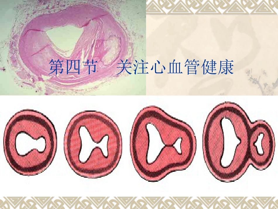 第四节关注心血管健康讲解_第1页