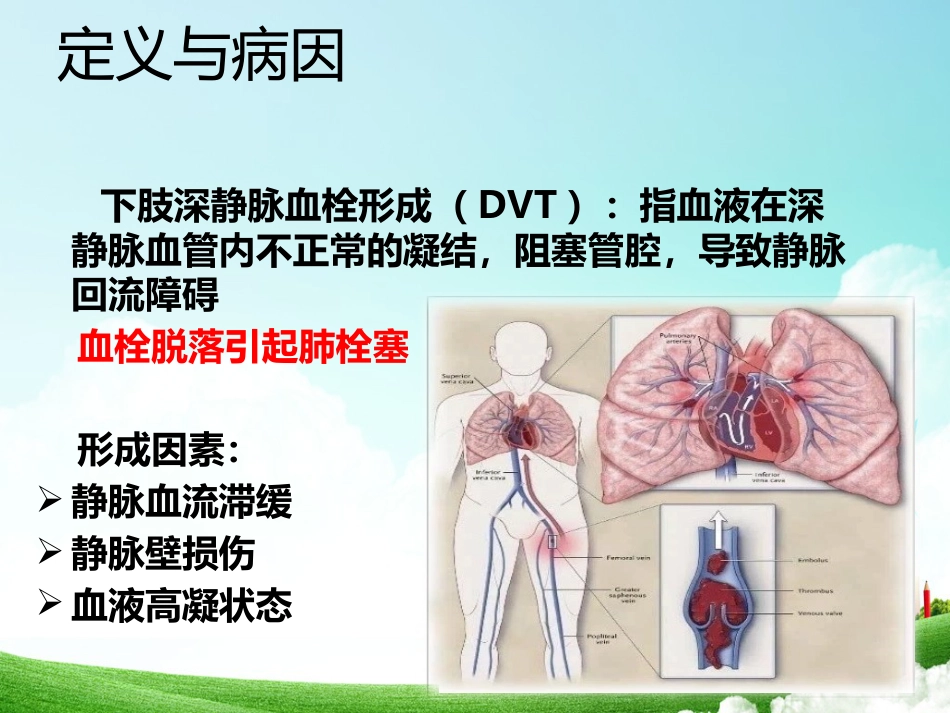 下肢深静脉血栓形成静脉置管溶栓术后-用药及出血观察护理-PPT_第3页