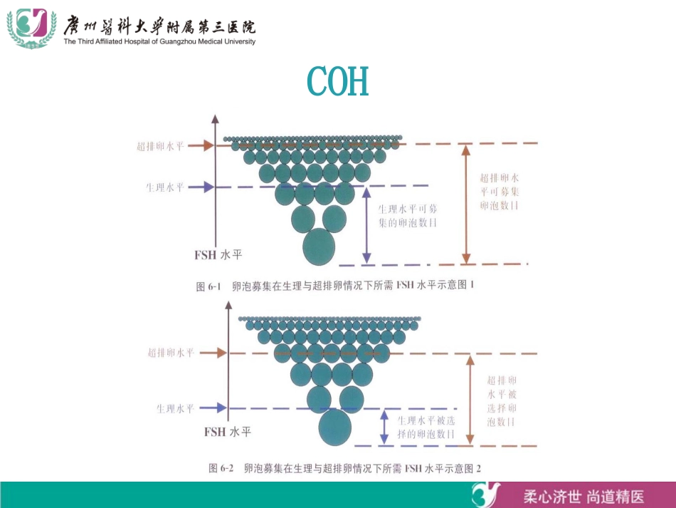 常见ART方案_第3页