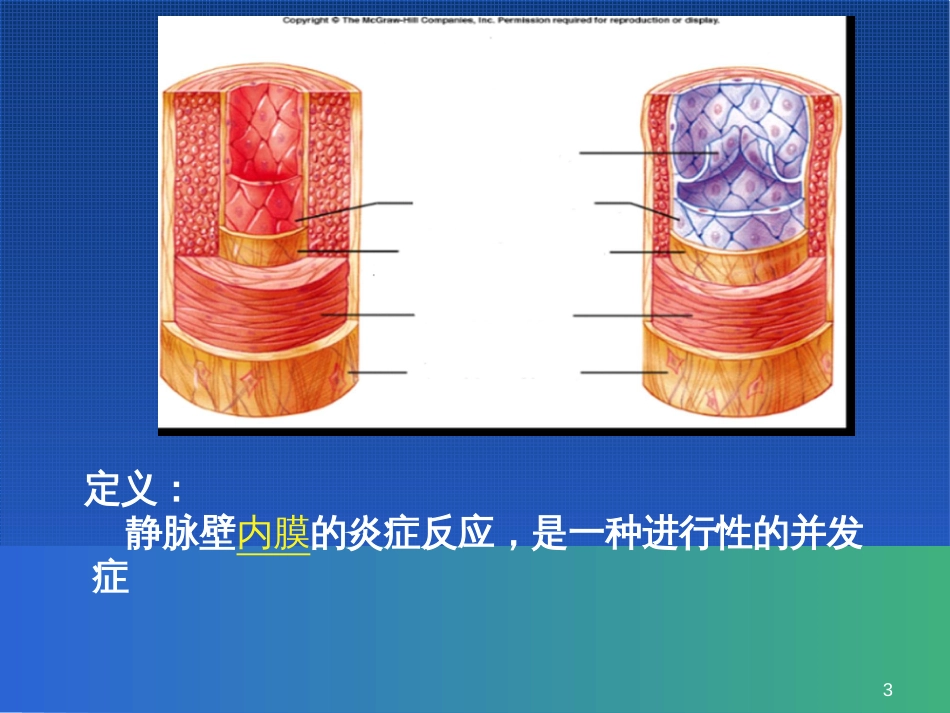 静脉炎ppt课件[共41页]_第3页