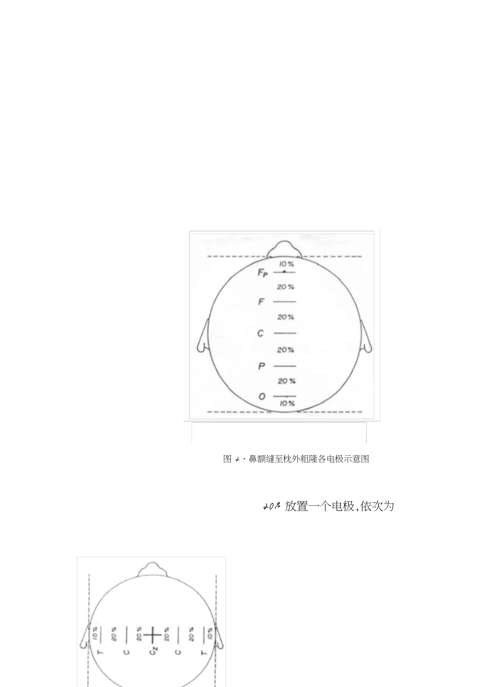 脑电图操作规范[共16页]_第3页