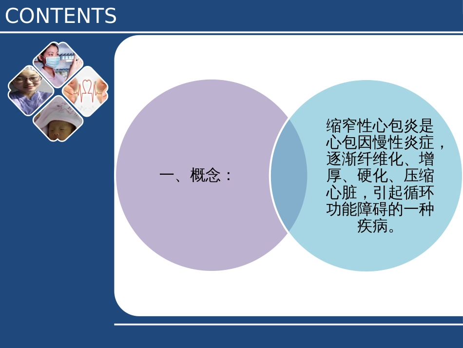 缩窄性心包炎围手术期护理[共29页]_第2页