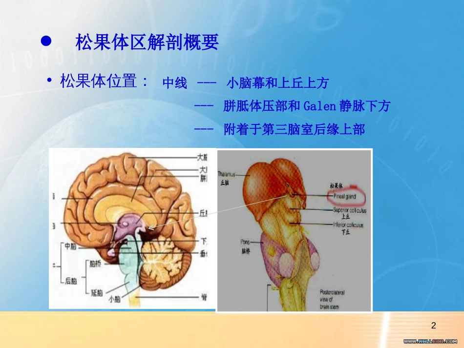 松果体区病变影像学表现[共36页]_第2页