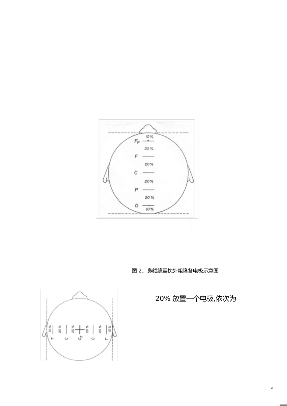 脑电图操作规范[共28页]_第3页