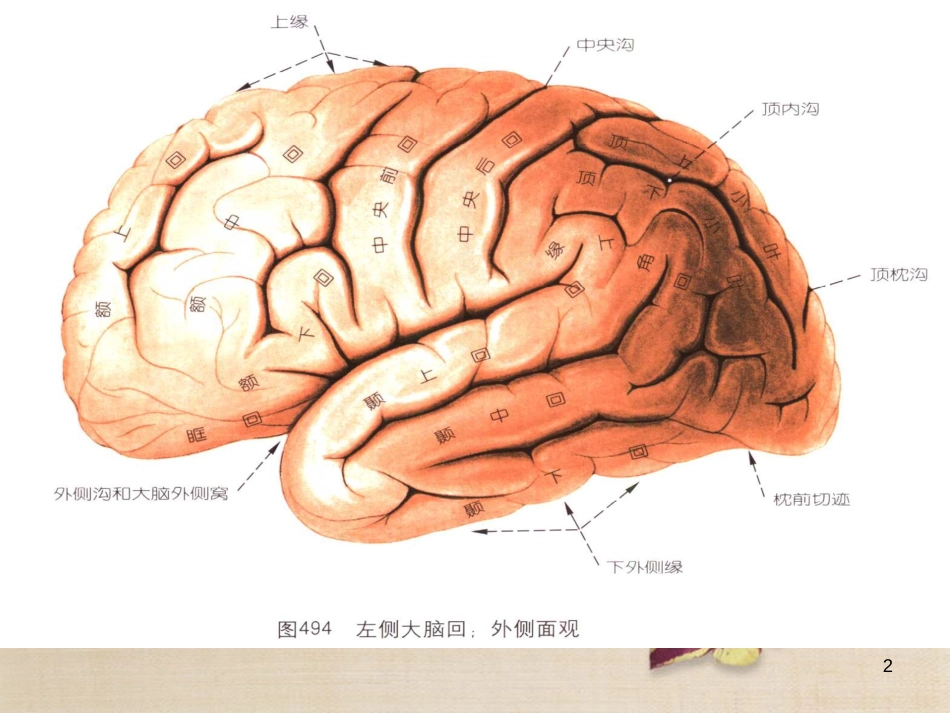 脑出血磁共振[共10页]_第2页