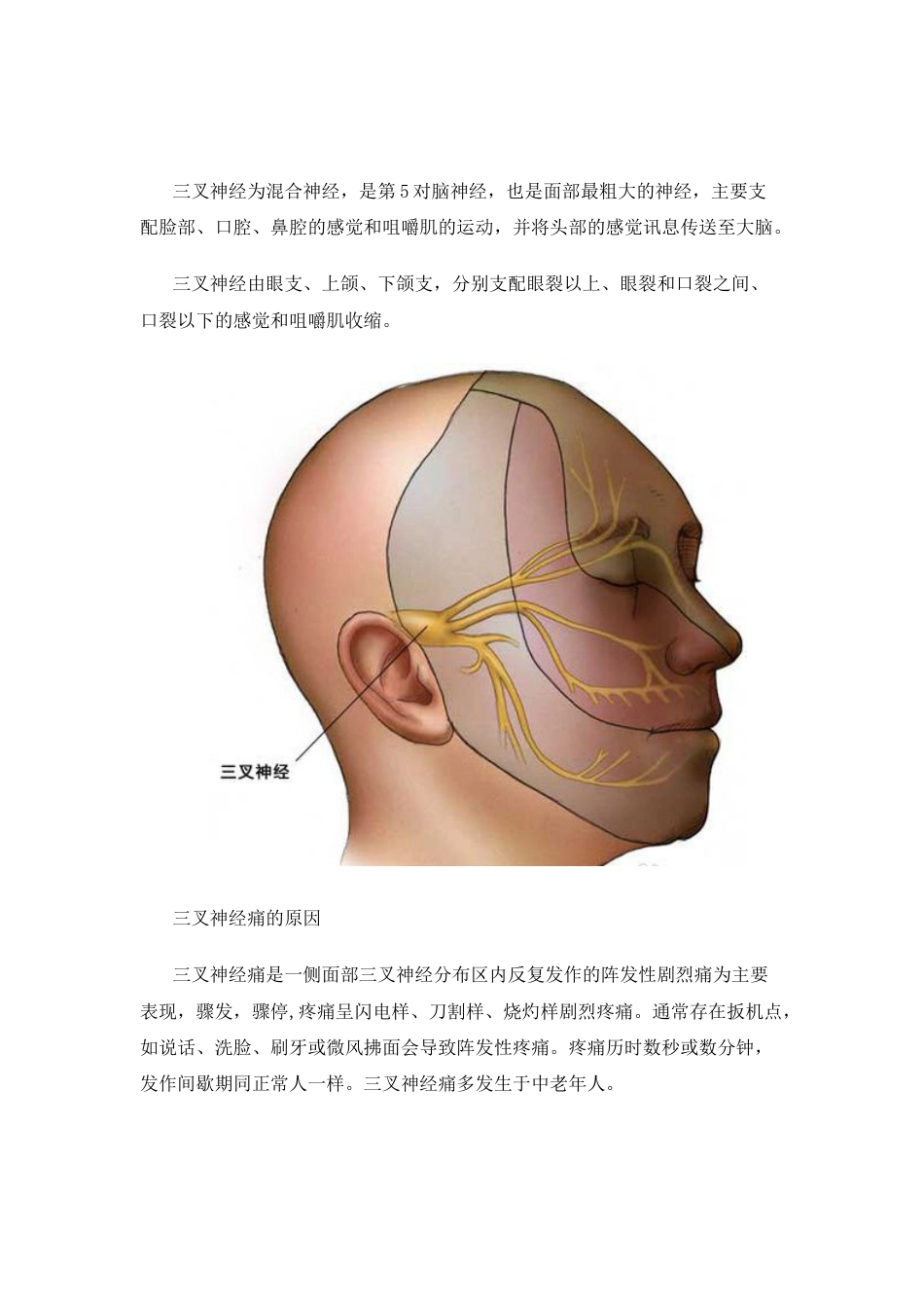 图解微血管减压手术治疗三叉神经痛的过程[8页]_第1页