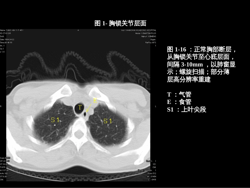 肺叶分段段ct(共80页)_第1页