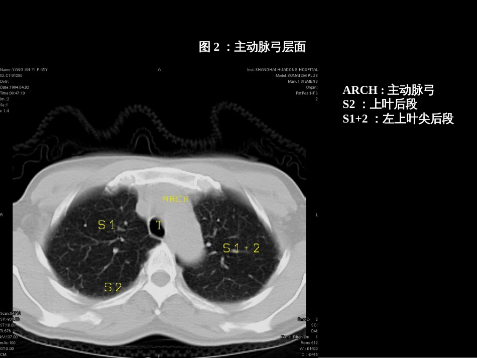 肺叶分段段ct(共80页)_第2页