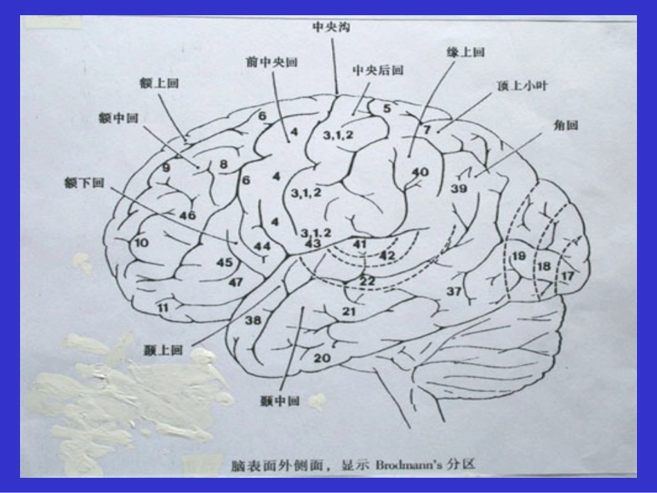 开颅手术切口设计[64页]_第3页