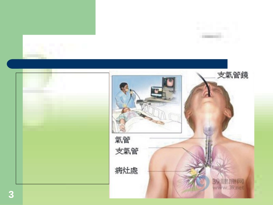 纤维支气管镜[共105页]_第3页