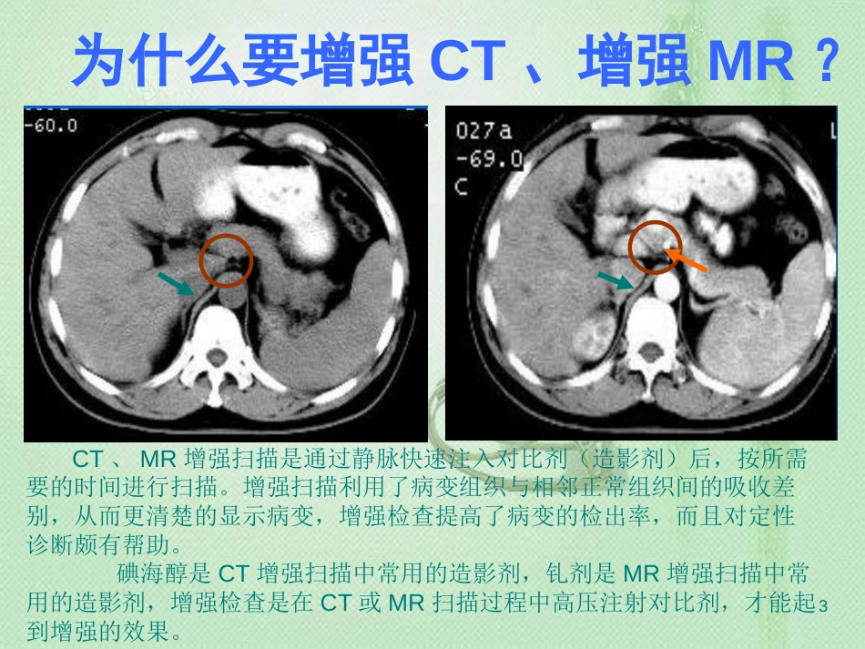 造影剂(对比剂)外渗预防与处理ppt课件[共24页]_第3页