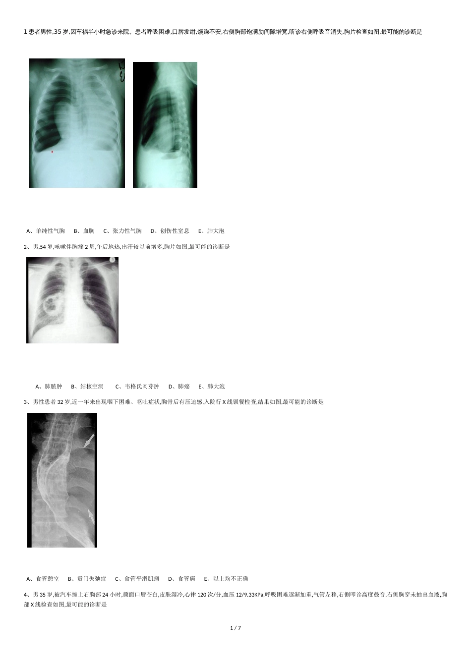 胸外科影像试题1_第1页