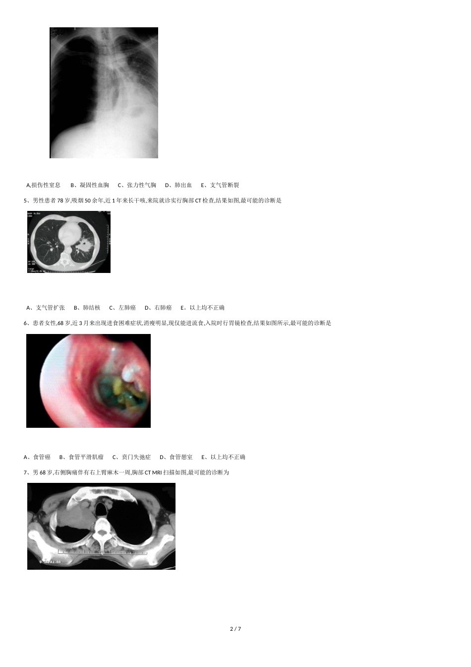胸外科影像试题1_第2页