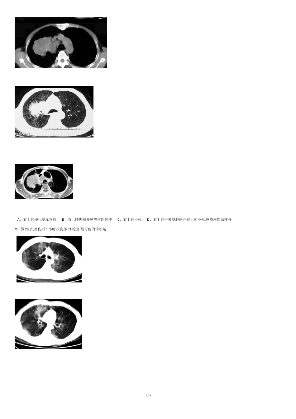 胸外科影像试题1_第3页