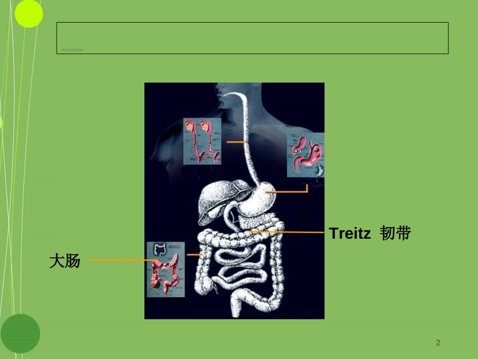 下消化道出血的诊治[共48页]_第2页