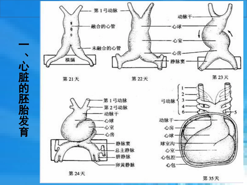 循环系统疾病患儿的护理课件_第3页