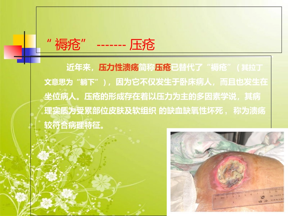 压疮管理[共57页]_第3页