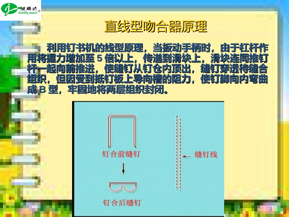 直线型缝合器操作步骤[共15页]_第3页