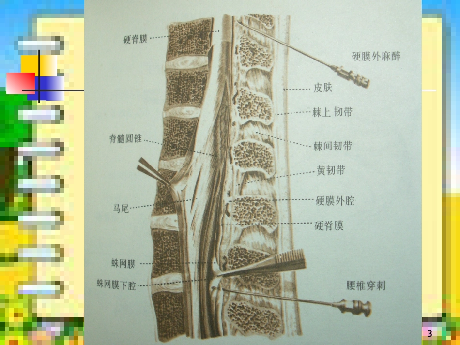 椎间盘突出的CT诊断[共41页]_第3页