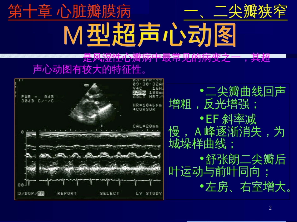 心脏彩超诊断[共43页]_第2页