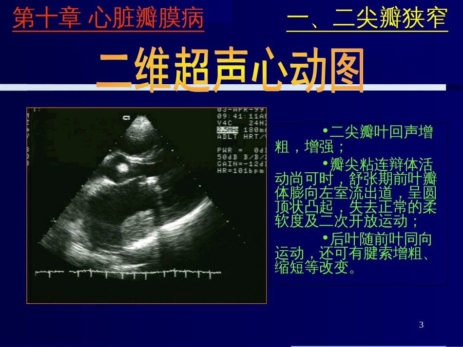 心脏彩超诊断[共43页]_第3页