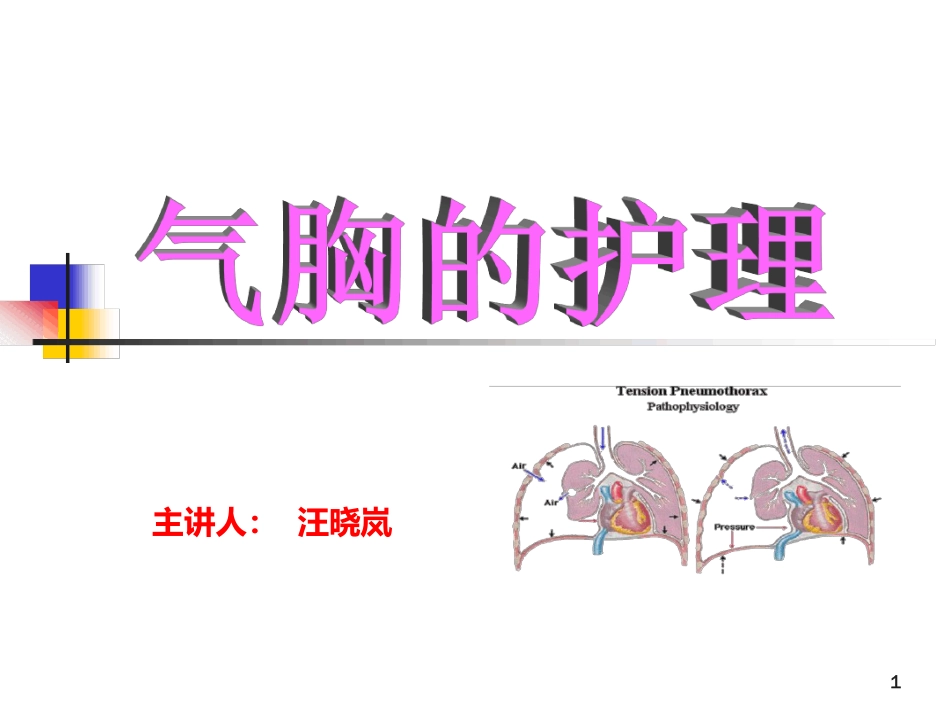 气胸的分类及护理ppt课件[共23页]_第1页