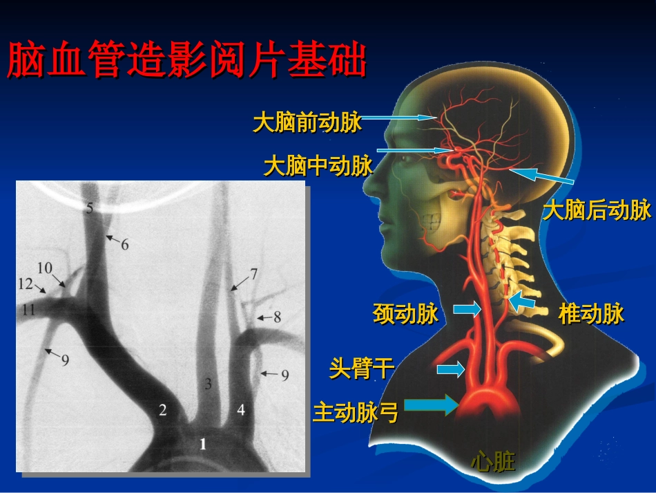 脑血管造影阅片[87页]_第1页