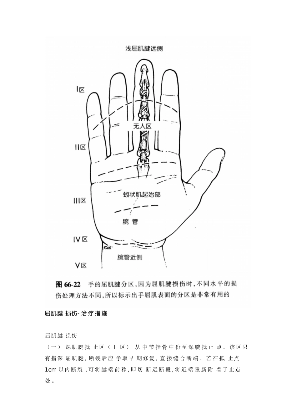 手屈肌腱分区及处理[共3页]_第1页